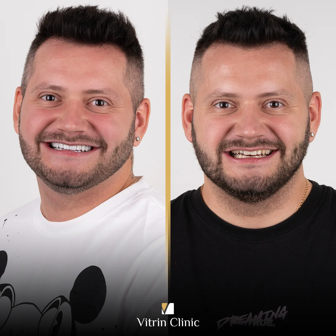Yarasalu b&a